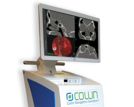 System Elektromagnetycznej Neuronawigacji Laryngologicznej